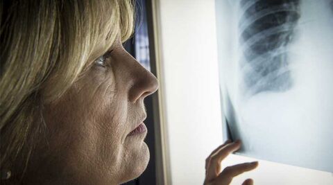 Improving access to health services: medical professional holding an X-ray