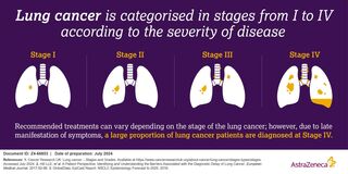 This animated graphic explains the differences between the two main forms of lung cancer, and how the two main forms of lung cancer are staged.