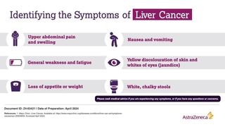 Identifying the Symptoms of Liver Cancer: The symptoms of liver cancer include upper abdominal pain and swelling; nausea and vomiting; general weakness and fatigue; yellow discolouration of skin and whites of eyes (jaundice); loss of appetite or weight; and white, chaky stools. 