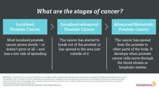 Stages of cancer infographic