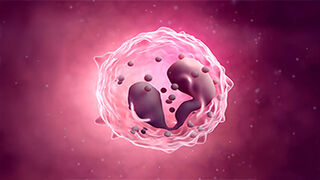 Eosinophil in Chronic Rhinosinusitis with Nasal Polyps illustration